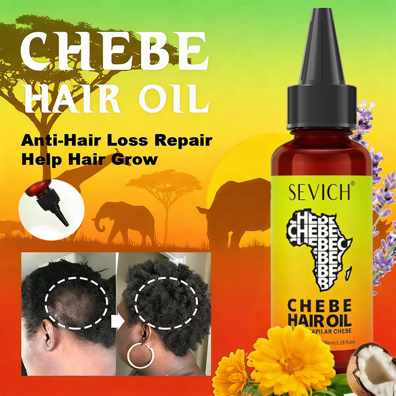 Hair Care Essence Oil Spray - Huile de croissance rapide des cheveux
