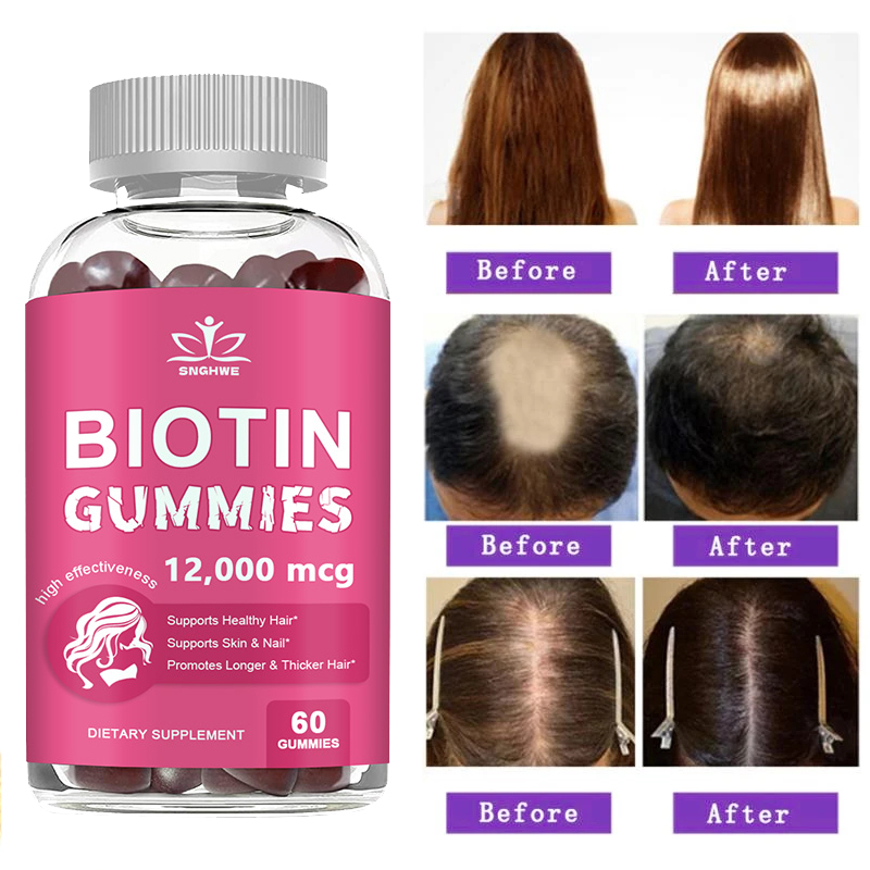 Hair Care Gummies - Gommes au collagène, gommes à biotine