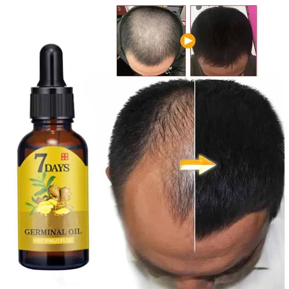 Hair Care Essence Oil Spray - Huile essentielle de gingembre pour la