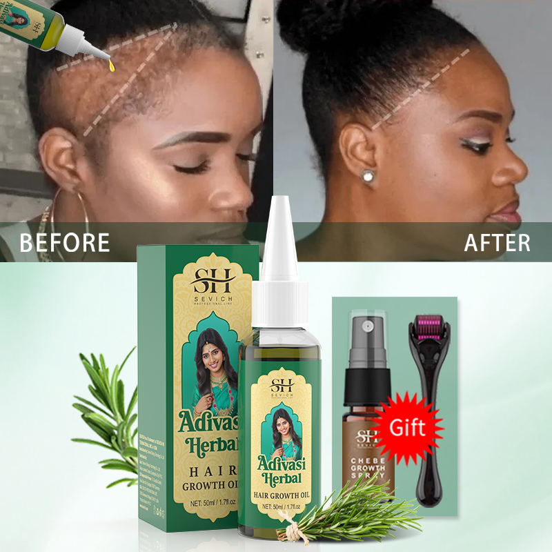 Huile de croissance capillaire - Hair Care Essence Oil Spray avis et prix