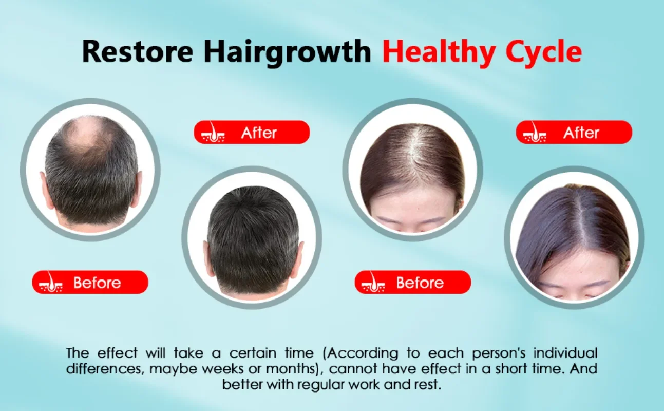 Bonnet de croissance des cheve - Hair Care Vegan avis et prix